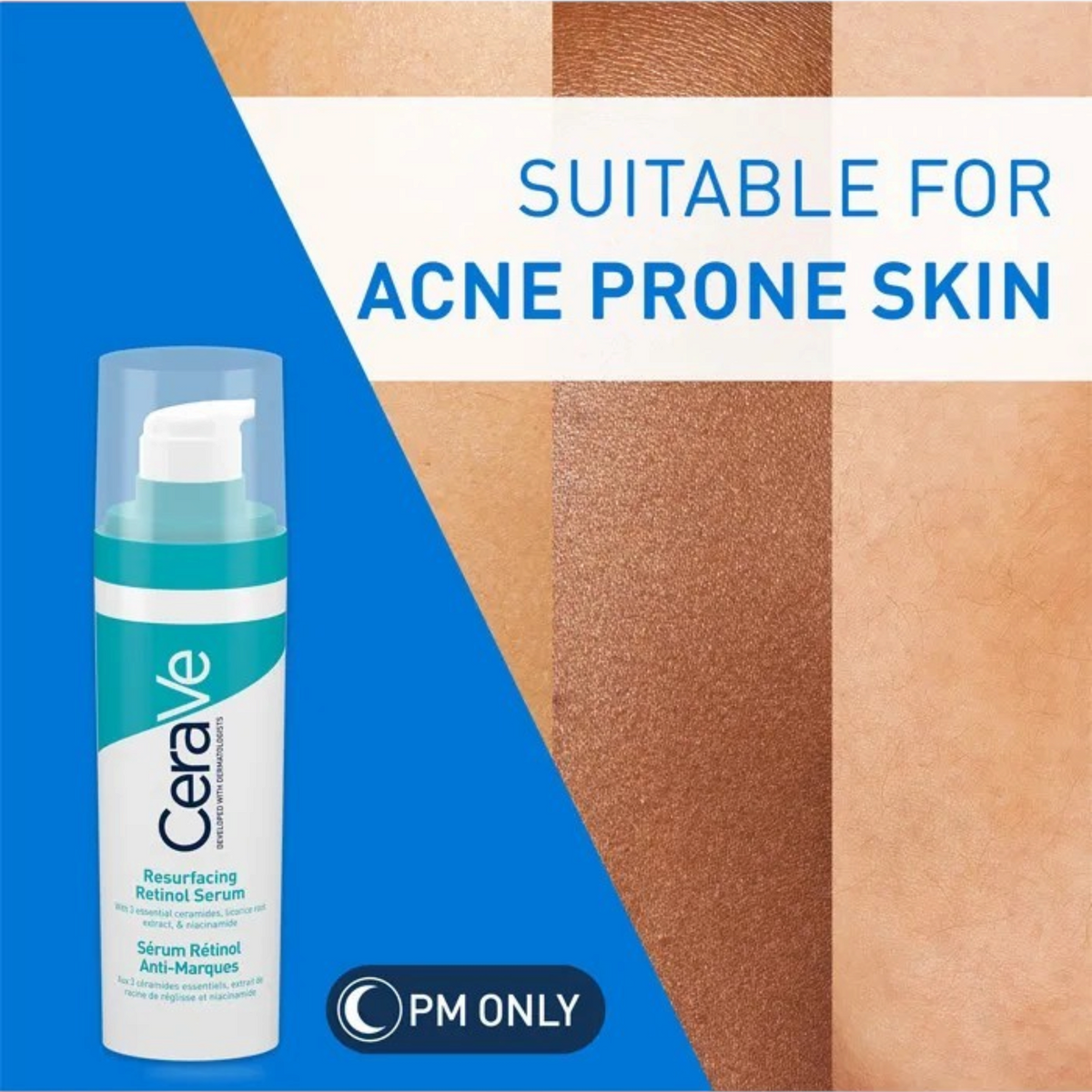 Lumina Pharmacy CeraVe Resurfacing Retinol Serum bottle with text overlay highlighting suitability for acne-prone skin
