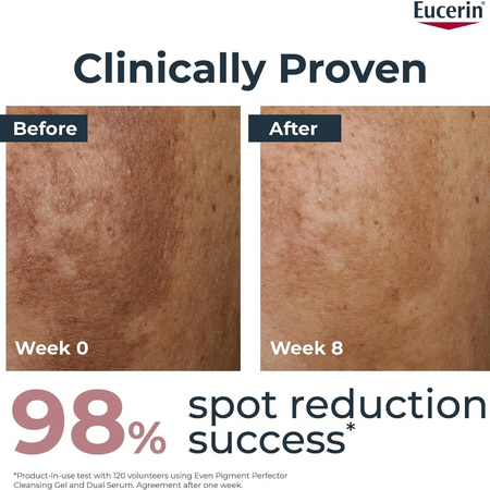 Lumina Pharmacy Eucerin Even Pigment Perfector before and after skin results showing 98% spot reduction success